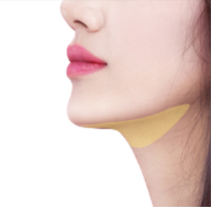 지방이 파괴되고 콜라겐이 생성되어 탄력 유지 및 처짐 방지