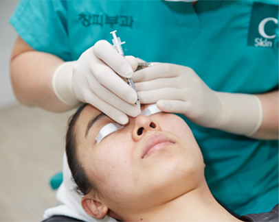 도트필 (Dot Peel)