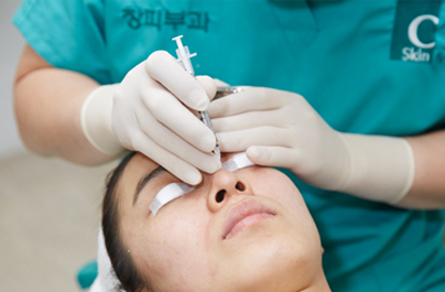 도트필 (Dot Peel)