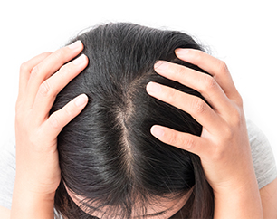 지루성 피부염, 모낭염 등 두피 질환