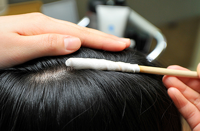 Scalp Scaling 두피 스케일링